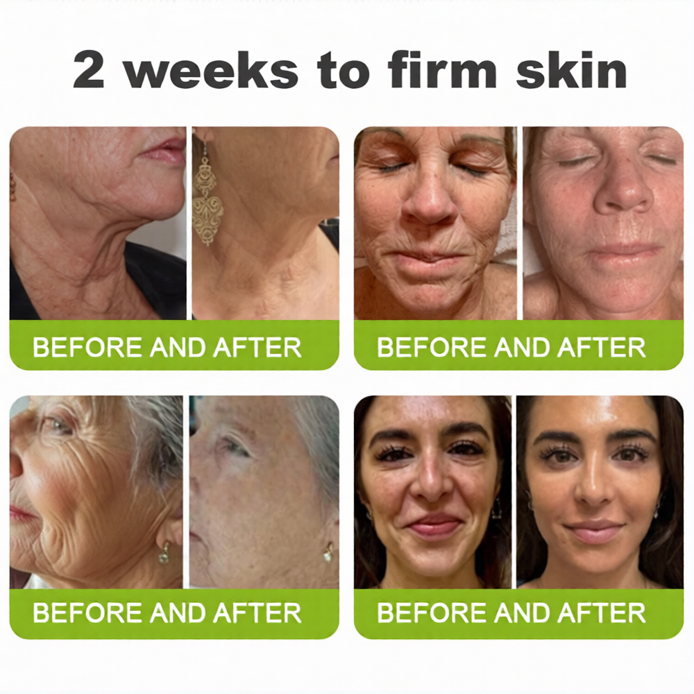 💫 Botox & Vita-A Retinol Shot Wrinkle-Lift Tightening cream - Last Day Promotion 70% OFF
